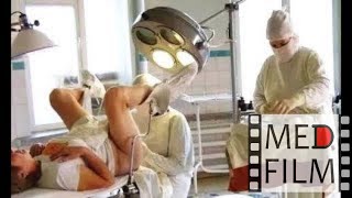 Внематочная беременность. Операция © Surgery for an ectopic pregnancy