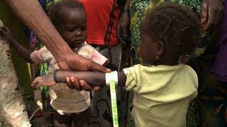 NGO fights against child malnutrition in Niger