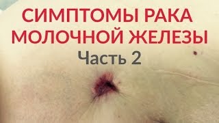 Симптомы рака молочной железы. Часть 2.