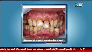 الدكتور | ابرز مشاكل الأسنان وخطوات تجميلها مع دكتور شادى على حسين