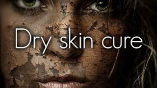 HOW TO: CURE DRY SKIN!!!!