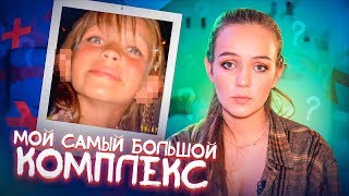 Я МЕЧТАЛА ОБ ОПЕРАЦИИ! Мой самый большой комплекс?
