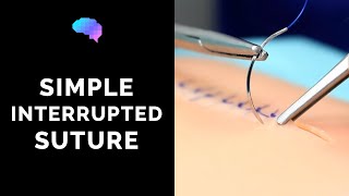 Simple interrupted suture (wound suturing) - OSCE Guide