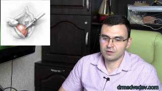 Медведев о кисте бартолиновой железы