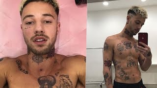 OMG What Happened to Cameron Dallas?