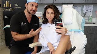 Chantel Jeffries Microneedling/PRP Experience and Thoughts