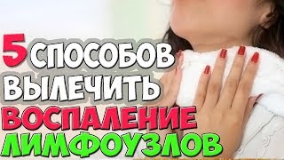 Как Лечить ВОСПАЛЕНИЕ ЛИМФОУЗЛОВ на Шее? ✅5 Способов Лечения ЛИМФОУЗЛОВ на Шее в Домашних Условиях