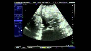 25W2D妊婦健診（５回目）2011.12.13