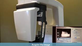 Carestream Dental CBCT Untrimmed Stone Model Scanning  with the CS 9300 and CS 8100 3D Families