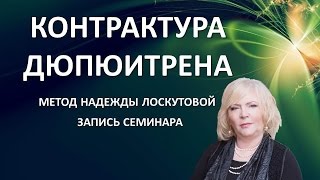 Контрактура Дюпюитрена