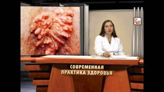 ПАПИЛЛОМА - симптомы, лечение, профилактика. Энциклопедия болезней, передающихся половым путем.