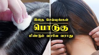 பொடுகு முற்றிலும் நீங்கி இனி வரவே வராது | Anti-Dandruff Treatment Remedies & Tips at Home