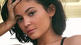 Kylie Jenner REMOVES Lip Fillers! Spills All Her SECRETS!