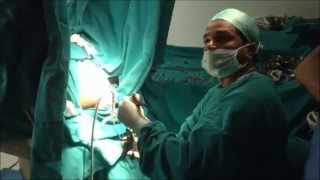 VAAFT Surgery For Fistula in Ano - Dr Ashish Bhanot