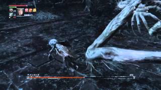 【ブラッドボーン】寄生虫 vs アメンドーズ【Bloodborn / Kos Parasite vs Amygdala】
