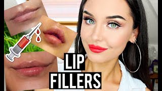 MY LIP FILLERS EXPERIENCE ? BEFORE AND AFTER JUVEDERM VOLIFT LIPS | KatesBeautyStation