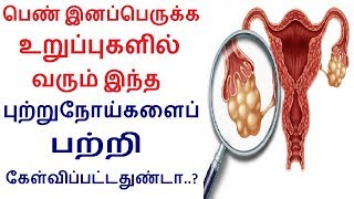 Gynecologic Cancers Signs & Symptoms in Tamil | Rahul Women Cancer Health Tips in Tamil