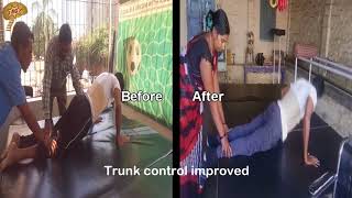 Stem Cell Therapy for Spinal Cord Injury with Objective Evidence | Quick Look | No. 5792