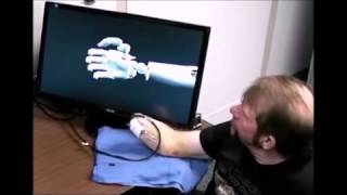 Amputee controls fingers on virtual hand.
