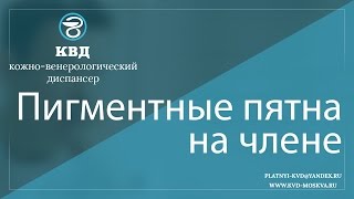 181  Пигментные пятна на члене