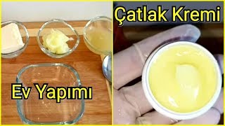 Kurumuş Çatlak Topuklara İyi Gelen Ev Yapımı Krem