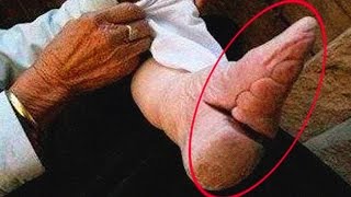 La Cruel Moda de Los Pies de Loto