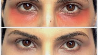 How to: Use Red Lipstick to Cover/Hide/Mask Dark Under Eye Circles/Colour Correct? | Manisha Moments