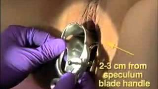 examen pelvico pelvic exam vagina exam Dr EHISTEN GODOY PACHECO MEDICINA GENOMICA VIROLOGIA OFTALMOLOGIA TELEMEDICINA HEMATOLOGIA NEUROLOGIA BIOMEDICINA