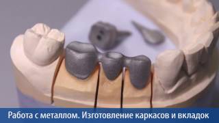 Как изготавливать мостовидные каркасы, одиночные колпачки.