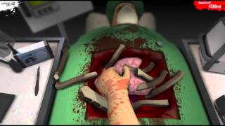 Surgeon Simulator 2013 - IT'S HAMMER TIME!