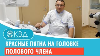 Красные пятна на головке полового члена