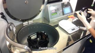 stem cell lifting, scaffold lifting with stem cell, 줄기세포리프팅 녹는실