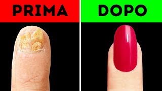 100 IN DIRETTA CON I MIGLIORI TRUCCHI CHE OGNI RAGAZZA DOVREBBE CONOSCERE E CONDIVIDERE CON LE SUE A