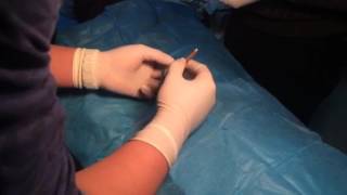 Painless, Safe Male Circumcision with innovative RYPS Circumcision Stapler