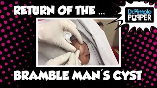 Return of the Cyst: with Bramble Man