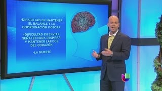 ¿Cómo el Alzheimer se apodera del cerebro? -- Noticiero Univisión