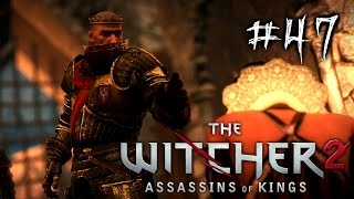 Eye Gouging - The Witcher 2 Ep. 47