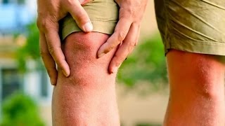 Болят суставы рук и ног что делать ! Как лечить боли в суставах - №1 Артрит. Артроз