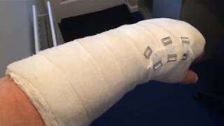 G0SEC Shack Video Delay due to I Have Broke my Wrist!!