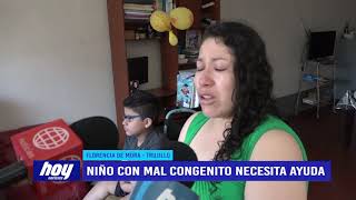 Niño con mal congénito necesita ayuda
