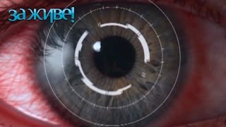 Как вылечить конъюнктивит – За живе! Сезон 4. Выпуск 13 от 20.03.17