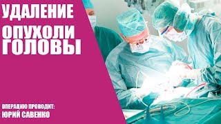 Удаление опухоли головы/Операция