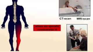 Hernia - symptomen en operatie