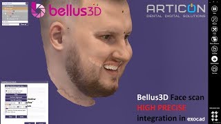 Bellus3D Face scan HIGH PRECISE integration in Exocad