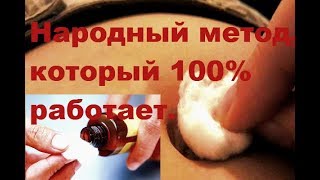 Засуньте ватный шарик себе в пупок - и уйдут кашель, простуда и менструальные боли!  # топ5хайп