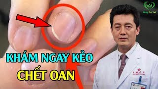 Nhìn Móng Tay Đoán Ngay Bệnh Tật, Xem Ngay Để Biết Kẻo Suy Gan Thận