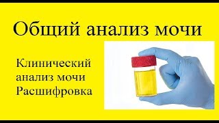 Общий анализ мочи (ОАМ), клинический анализ мочи.