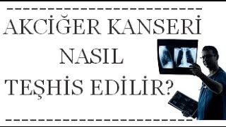 Akciğer Kanseri Nasıl Teşhis Edilir?