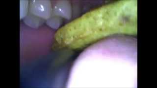 1st POV vore video. Inside mouth throat and esophagus view