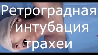 Техника ретроградной интубации трахеи - meduniver.com - meduniver.com